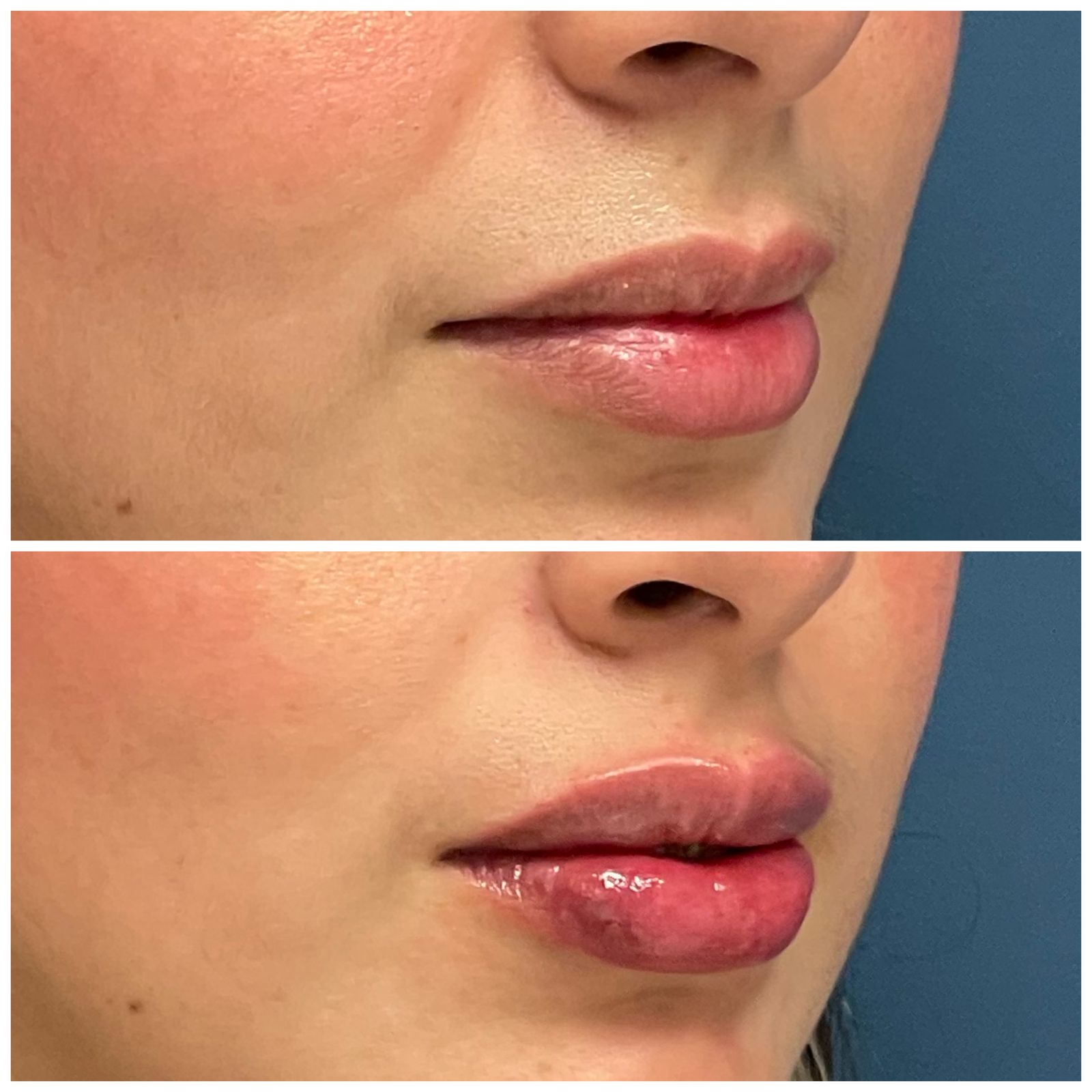 Medicina estética baja california