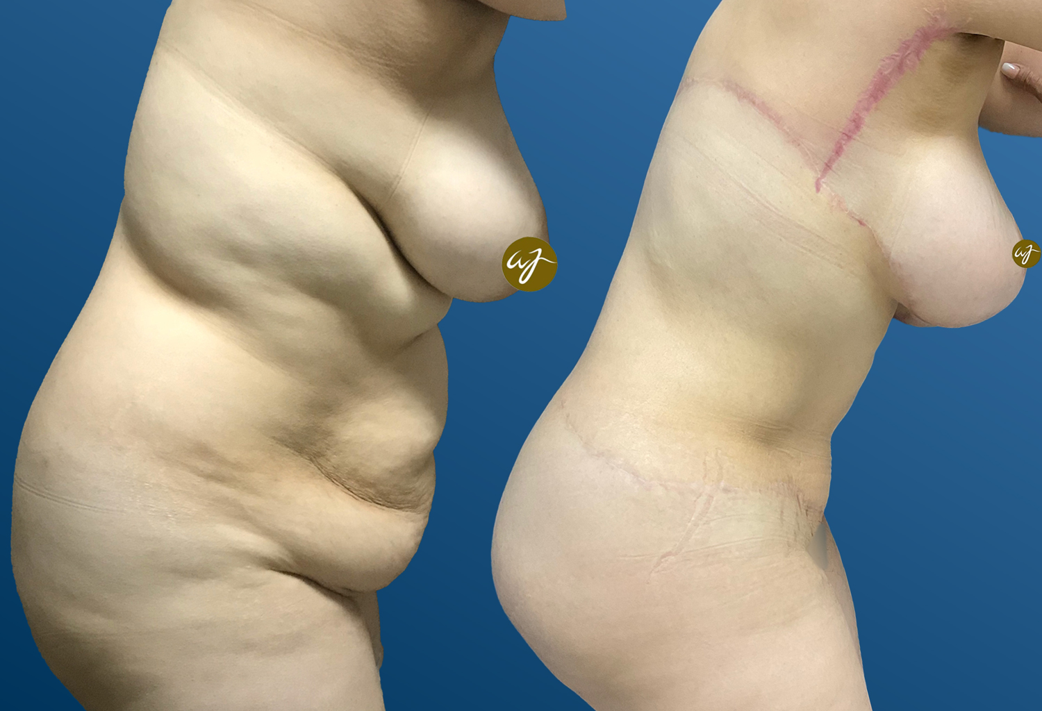 Antes-y-despues-arreglado-13