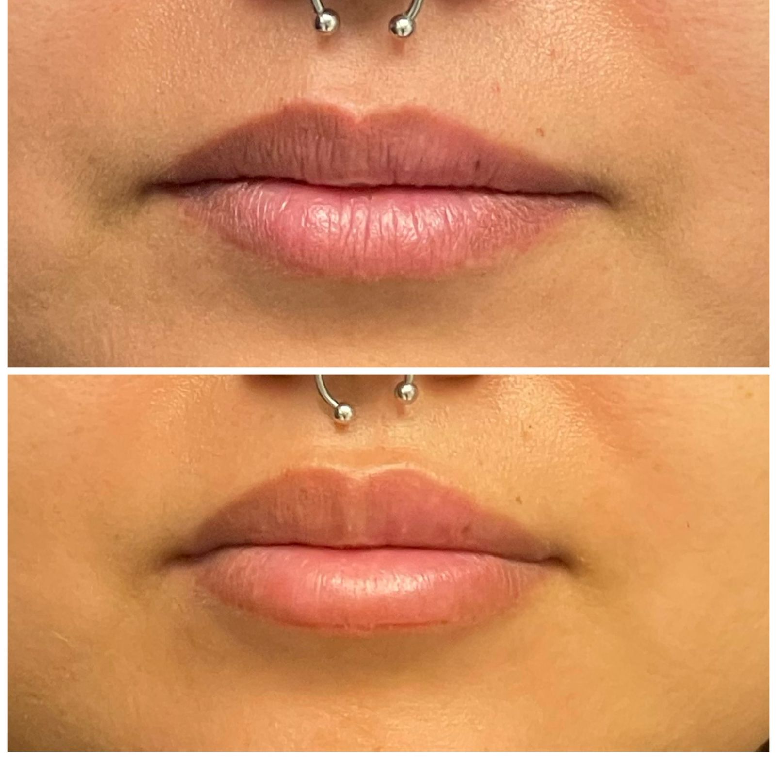 Medicina estética mexicali